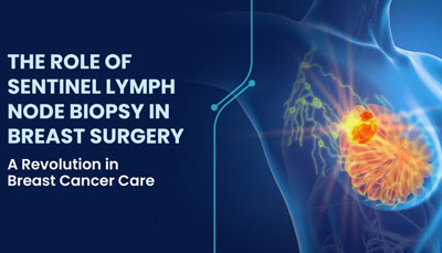 THE ROLE OF SENTINEL LYMPH NODE BIOPSY IN BREAST SURGERY