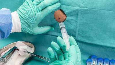 WHEN A BIOPSY COMES BACK INCONCLUSIVE: